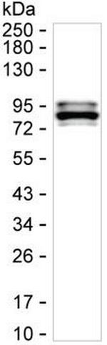 CARS Antibody in Western Blot (WB)