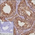 HSPA1A Antibody in Immunohistochemistry (Paraffin) (IHC (P))