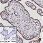 TRIM34 Antibody in Immunohistochemistry (Paraffin) (IHC (P))