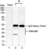 DNAJB6 Antibody in Immunoprecipitation (IP)