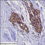 TBX3 Antibody in Immunohistochemistry (Paraffin) (IHC (P))