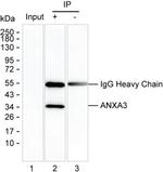 Annexin A3 Antibody in Immunoprecipitation (IP)