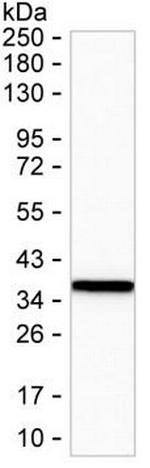 Annexin A3 Antibody in Western Blot (WB)