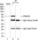 PKC delta Antibody in Immunoprecipitation (IP)