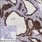 IQGAP2 Antibody in Immunohistochemistry (Paraffin) (IHC (P))