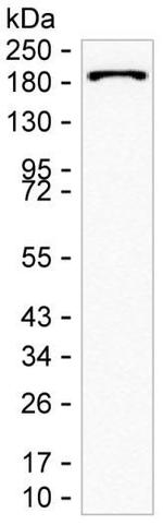 IQGAP2 Antibody in Western Blot (WB)