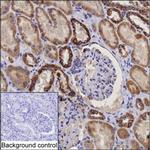 DLAT Antibody in Immunohistochemistry (Paraffin) (IHC (P))