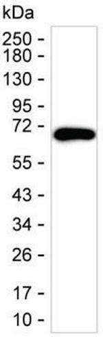 DLAT Antibody in Western Blot (WB)