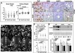 MUC1 Antibody in Immunohistochemistry (IHC)