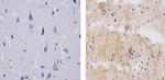 Synaptophysin Antibody in Immunohistochemistry (Paraffin) (IHC (P))