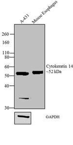 Cytokeratin 14 Antibody in Western Blot (WB)