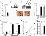 Tryptase Antibody in Western Blot (WB)