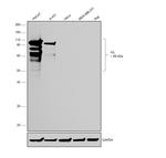 Involucrin Antibody in Western Blot (WB)