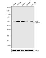 CHK2 Antibody in Western Blot (WB)