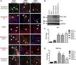 alpha Synuclein Antibody in Immunocytochemistry (ICC/IF)