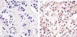 p53 Antibody in Immunohistochemistry (Paraffin) (IHC (P))