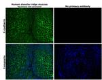 E-cadherin Antibody in Immunohistochemistry (Paraffin) (IHC (P))