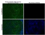 E-cadherin Antibody in Immunohistochemistry (Paraffin) (IHC (P))