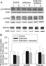 Tau Antibody in Western Blot (WB)