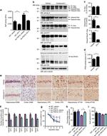 Tau Antibody in Western Blot (WB)