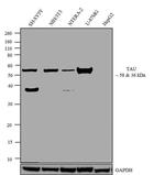 Tau Antibody in Western Blot (WB)