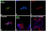 CD20 Antibody