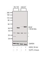 VEGF Antibody in Western Blot (WB)