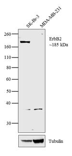 ErbB2 (HER-2) Antibody in Western Blot (WB)