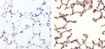 MUC1 Antibody in Immunohistochemistry (Paraffin) (IHC (P))