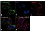 Tyrosinase Antibody in Immunocytochemistry (ICC/IF)