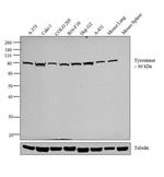 Tyrosinase Antibody in Western Blot (WB)