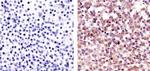 c-Abl Antibody in Immunohistochemistry (Paraffin) (IHC (P))