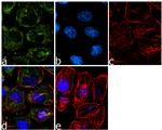 ErbB2 (HER-2) Antibody in Immunocytochemistry (ICC/IF)