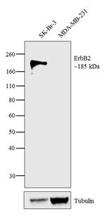 ErbB2 (HER-2) Antibody in Western Blot (WB)