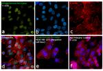 Progesterone Receptor Antibody in Immunocytochemistry (ICC/IF)