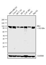 HK2 Antibody in Western Blot (WB)