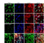 SUMO1 Antibody