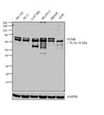 NUMB Antibody in Western Blot (WB)