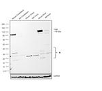 TrkB Antibody in Western Blot (WB)