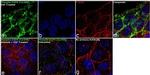 Phospho-EGFR (Tyr998) Antibody