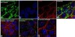 Phospho-EGFR (Tyr998) Antibody in Immunocytochemistry (ICC/IF)