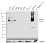 STAT4 Antibody in Western Blot (WB)