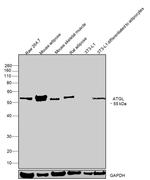 ATGL Antibody in Western Blot (WB)