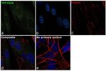 PPP2R2A Antibody in Immunocytochemistry (ICC/IF)