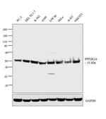 PPP2R2A Antibody in Western Blot (WB)