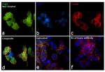 EGR1 Antibody in Immunocytochemistry (ICC/IF)