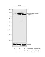 Phospho-PERK (Thr980) Antibody in Western Blot (WB)