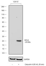 Phospho-MYL9 (Ser19) Antibody in Western Blot (WB)