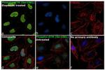 Phospho-ATM (Ser1981) Antibody in Immunocytochemistry (ICC/IF)