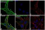 Phospho-PDGFRB (Tyr751) Antibody